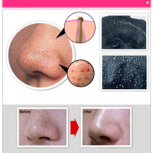 [Big Sale+Free Shipping]Suction Face Mask Deep Cleansing Face Mask Black Head Tearing Style Resist Strawberry Nose Acne Remover Blackhead Mud Masks